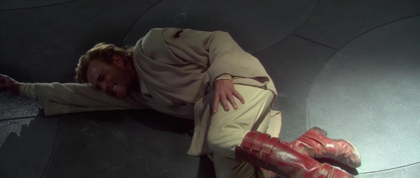 Obi-Wan Kenobi - Attack of the Clones - Wounded Obi-Wan